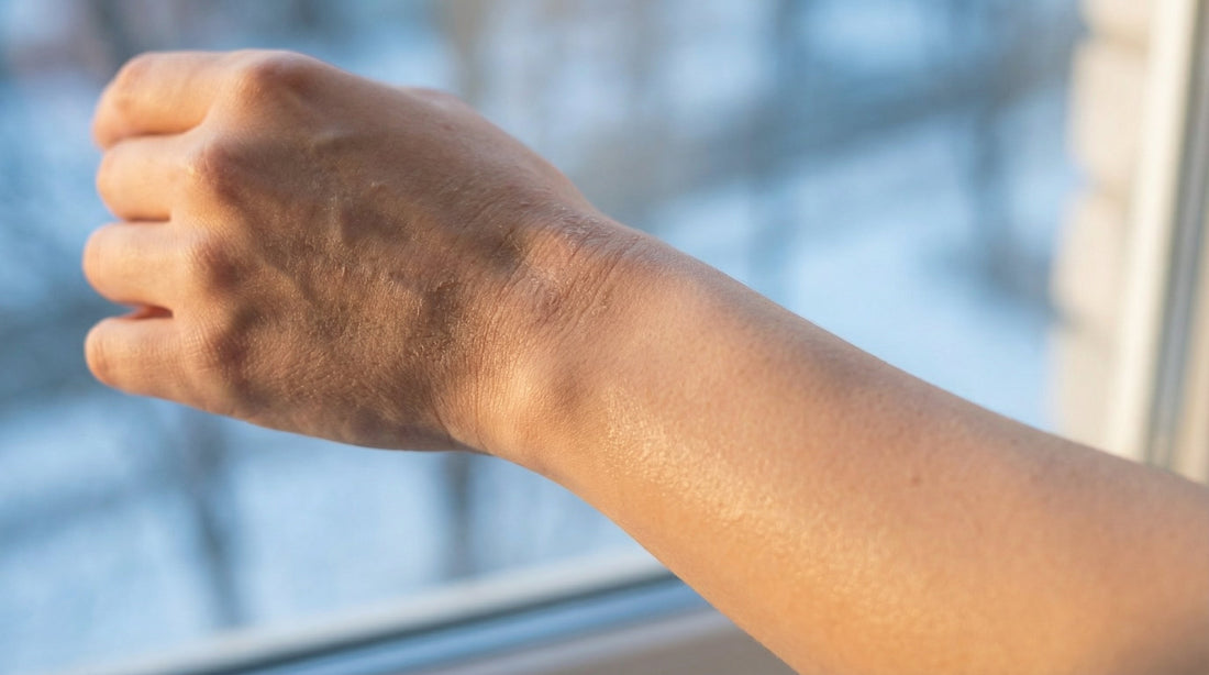 Your Five Biggest Moisturising Mistakes Exposed